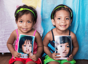 Sisters holding a before cleft surgery photo in front of his smiling post surgery smile. Photo cred: Operation Smile